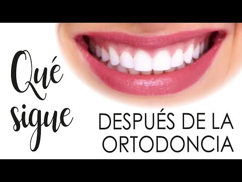 Dentista ortodoncia: mejora tu sonrisa hoy mismo