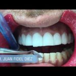 Dentista en Los Llanos de Aridane: Tu Sonrisa Perfecta