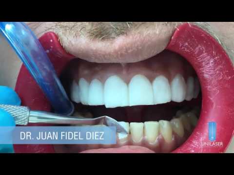 Dentista en Los Llanos de Aridane: Tu Sonrisa Perfecta