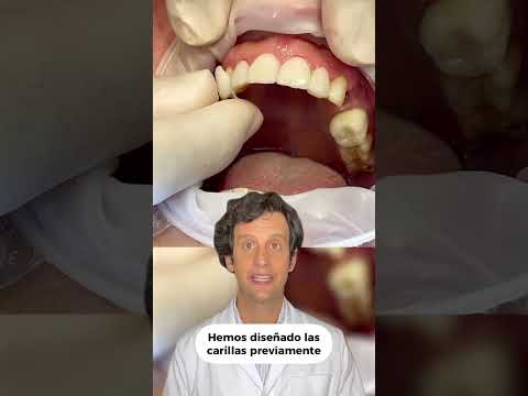 Dentista en Montequinto: Tu sonrisa perfecta está aquí
