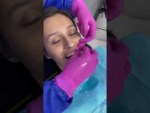 Dentista en San Pedro Alcántara: Cuidado dental de calidad cerca de ti