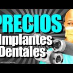 Dentistas baratos en Barcelona: Tu sonrisa perfecta al mejor precio