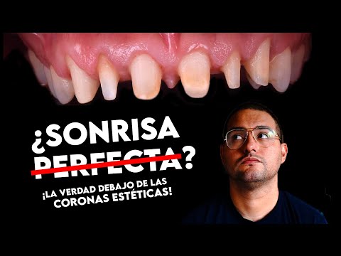Dentista en Miribilla: tu sonrisa perfecta